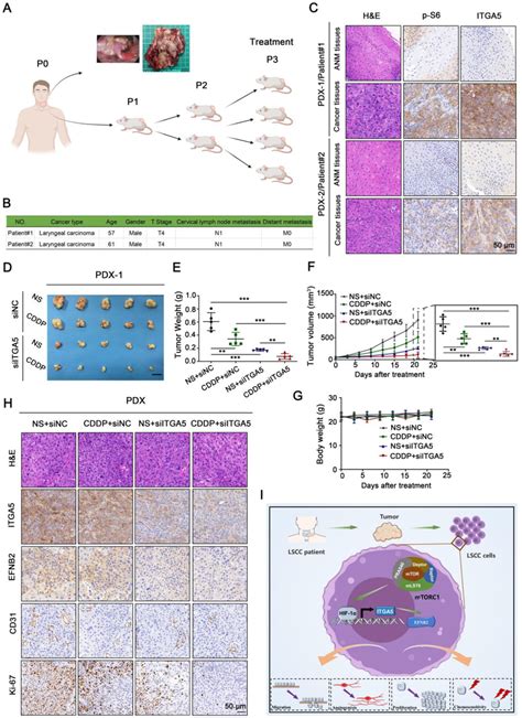 Knockdown Of ITGA5 Increases Chemosensitivity To CDDP In LSCC PDX