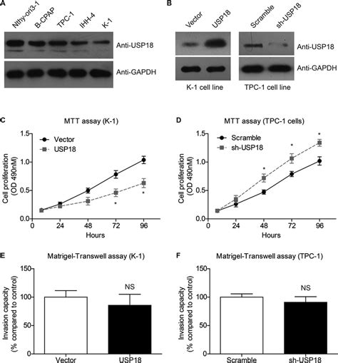 The Effects Of Usp On Papillary Thyroid Carcinoma Ptc Proliferation