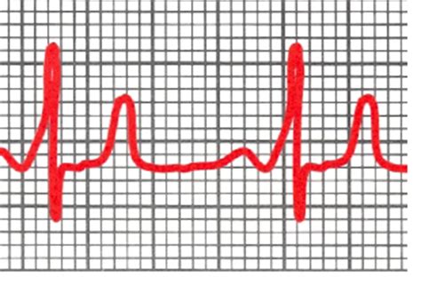 The History of Piedmont Healthcare in Georgia | Piedmont Healthcare