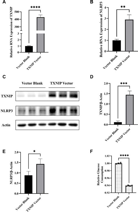 Effects Of TXNIP On Regulation Of NLRP3 Expression And Cellular Glucose