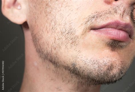 Short Sparse Beard On Mans Face Hair Growth Problems Man With