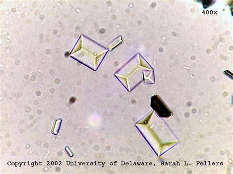 Triple Phosphate Crystals Coffin Lids Medical Laboratory Crystals