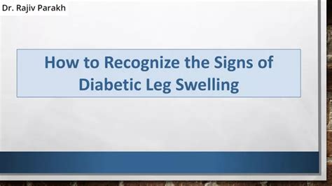 PPT - How to Recognize the Signs of Diabetic Leg Swelling PowerPoint ...