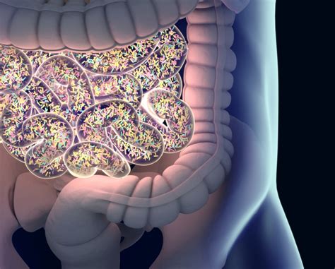 Rectosigmoid Endometriosis Pain, Symptoms Eased by Visanne in Study