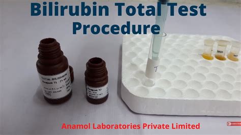 Bilirubin Test Procedure Bilirubin Total Test YouTube