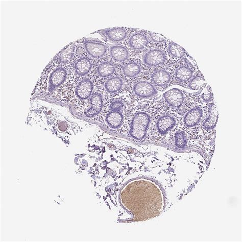 Tissue Expression Of Apoe Staining In Colon The Human Protein Atlas