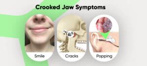 Asymmetrical Jaw & Chin: Causes and How to Fix it Naturally | Mewing.coach