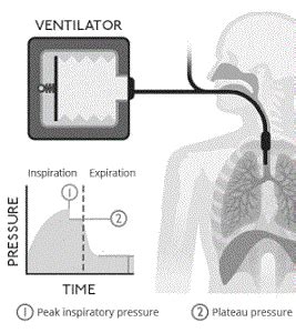 Plateau Pressure: Meaning, Calculation & Normal Values | Study.com