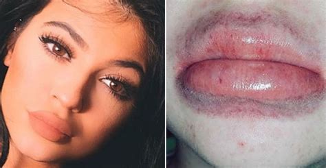 10 Celeb Trends As Dumb As Kylie Jenner S Lip Challenge