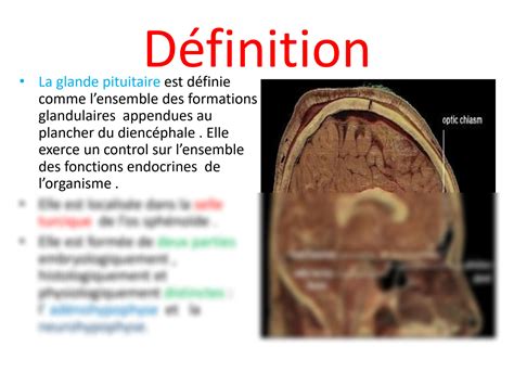 SOLUTION Histologie De La Glande Pituitaire Et Ses Relations Avec L