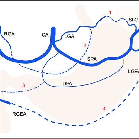 Collateral between the branches of celiac artery. CA, celiac artery ...