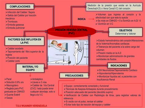 Presi N Venosa Central Pvc Ppt