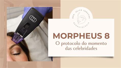 MORPHEUS 8 Conheça o protocolo do momento das celebridades YouTube