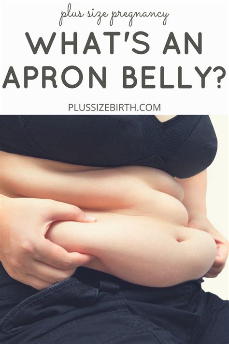 A Pannus Commonly Referred To As An Apron Belly Or Mothers Apron Is