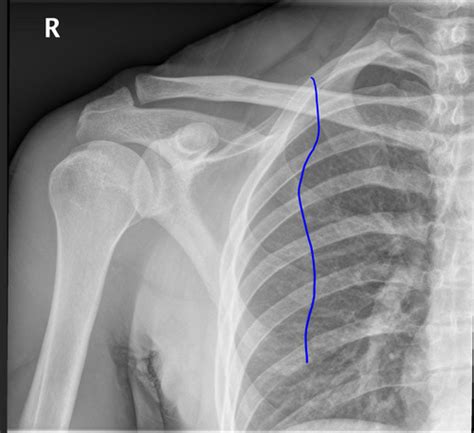 Radiology Final Flashcards Quizlet