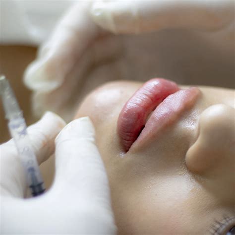 Injectables Sydney Blogs Retroderm Cosmetic Treatments By An Expert