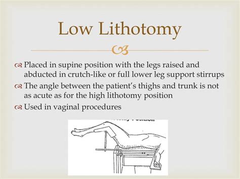 Lithotomy position abdullah | PPT