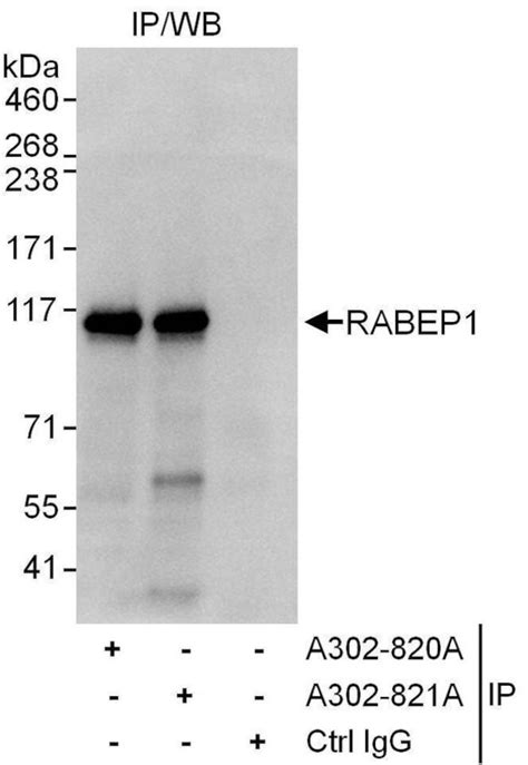 Rabep1 Polyclonal Antibody A302 820a T