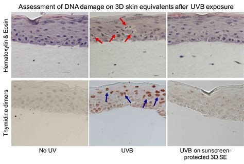 3D skin models for detection of UV damage - SkinAxis