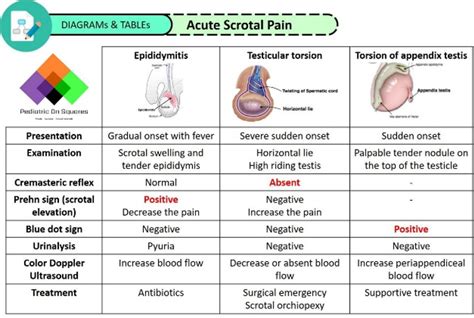 Testicular Torsion Cremasteric Reflex at Nancy Gibson blog