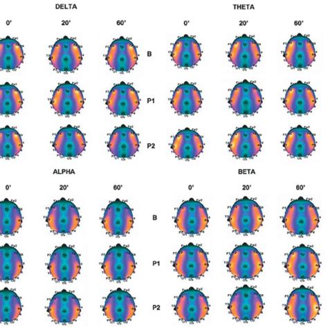 Cortical Dynamics Of Eeg Relative Power Variation Across Conditions