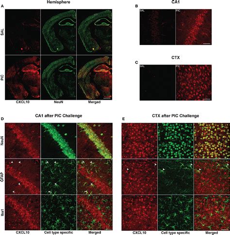 Frontiers Neuronal Cxcl Cxcr Axis Mediates The Induction Of