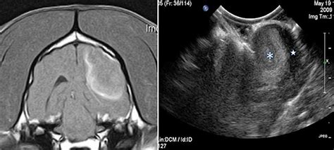 Frontiers Intraoperative Ultrasound Applications In Intracranial Surgery