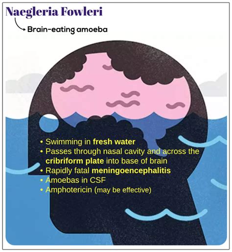 Naegleria fowleri - Medicine Keys for MRCPs