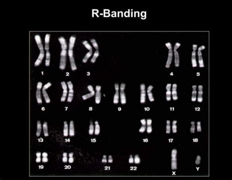 Ch Chromosome Variation Flashcards Quizlet