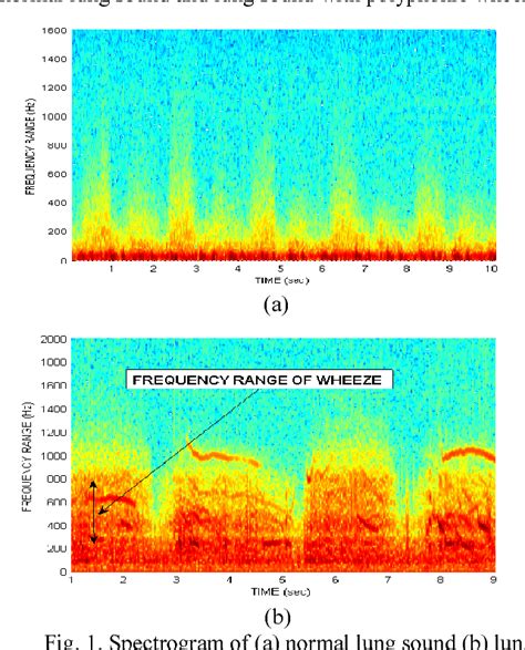 Lung sound analysis for wheeze episode detection | Semantic Scholar