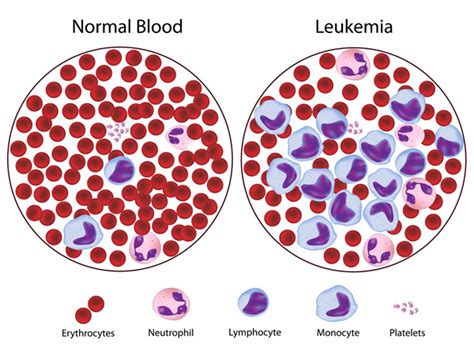 White Blood Cell Labeled