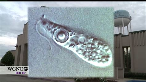 Deadly Brain Eating Amoeba Found In Louisiana Water System Aol News