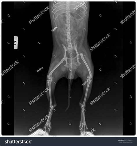 296 Hip Dislocation X Ray Images, Stock Photos & Vectors | Shutterstock