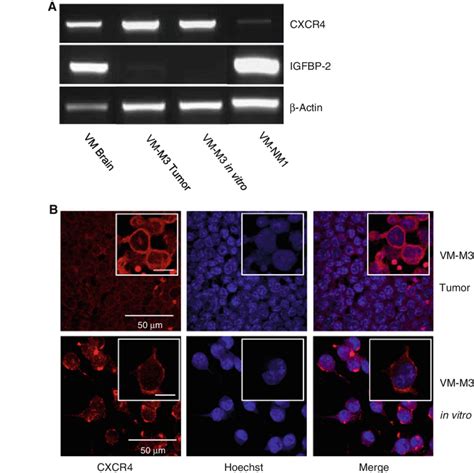 Expression Of CXCR4 And IGFBP 2 In Brain Tumor Tissue And In Cultured