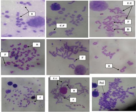 Photomicrographs Of Chromosomal Aberrations In Bone Marrow Cells Of