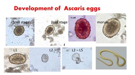 Ascaris Lumbricoides Ppt