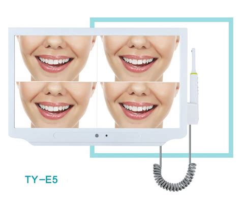 Monitor LCD 17inch Visor digital dental de alta definición de 10