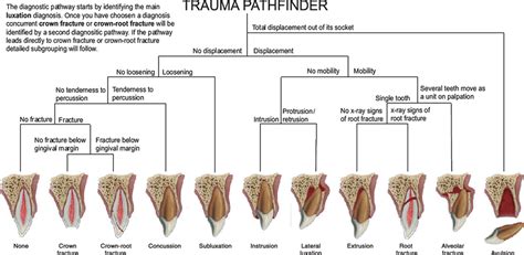 Dental Trauma Guide A Source Of Evidencebased Treatment Guidelines