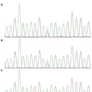 Sequence Chromatograms Of Akap A And B The Patient And Her Father