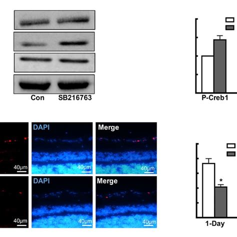 Sb216763 Protects Retinal Neurons From Ischemic Injury In Vivo A