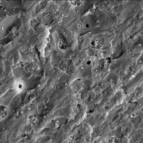 Scanning electron micrograph of ME Group X500. Fig (2) scanning ... 
