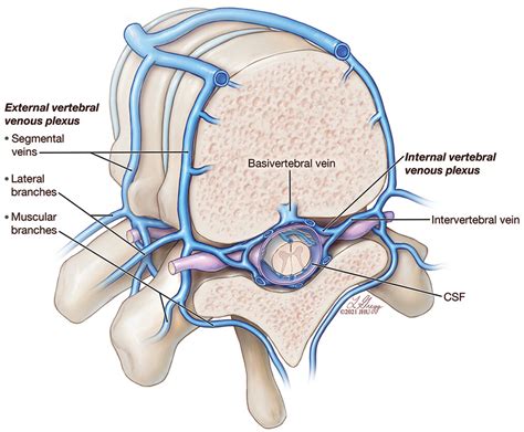 Csfvenous Fistulas Anatomy And Diagnostic Imaging Ajr