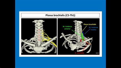 Plexus Brachialis Strahlentherapie Prof Hilke Vorwerk YouTube