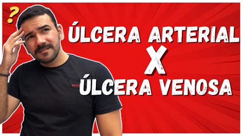 Ulcera Venosa vs Ulcera Arterial Conheça as diferenças Aula Completa