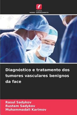 Diagn Stico E Tratamento Dos Tumores Vasculares Benignos Da Face By