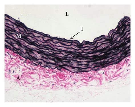 Verhoeff Van Gieson Staining Of The Aorta Magnification In