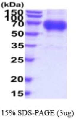 Recombinant Human Osteoactivin Gpnmb His Protein Nbp Bio Techne