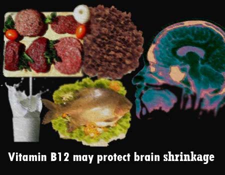 Deficiency of Vitamin B12 key to aging brain - Health Jockey