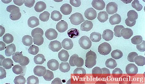 Plasmodium Malariae Characteristics Morphology Life Cycle Science 2025