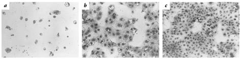 JCI The Cytolethal Distending Toxin From The Chancroid Bacterium